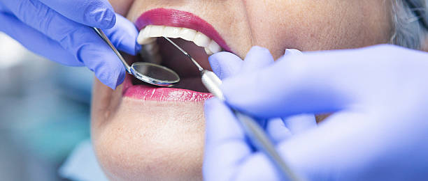 Best Emergency Root Canal Treatment in Morrisville, NY